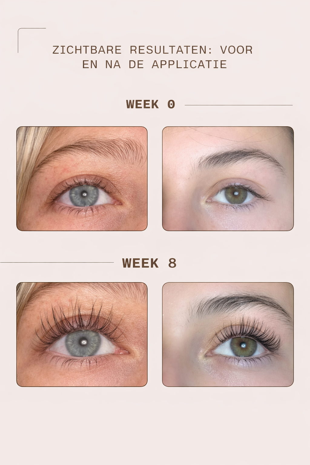 WimperBoost Serum™